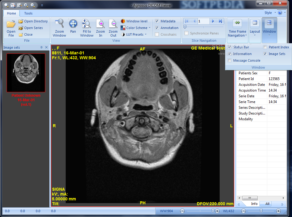 Dicom viewer