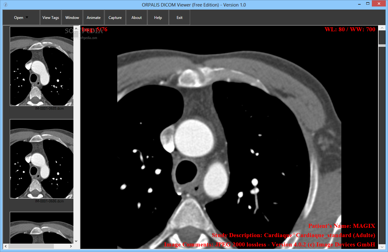 Dicom viewer. Dicom 3.0. Vidar Dicom. Просмотрщик кт снимков. Vidar Dicom viewer системные требования.