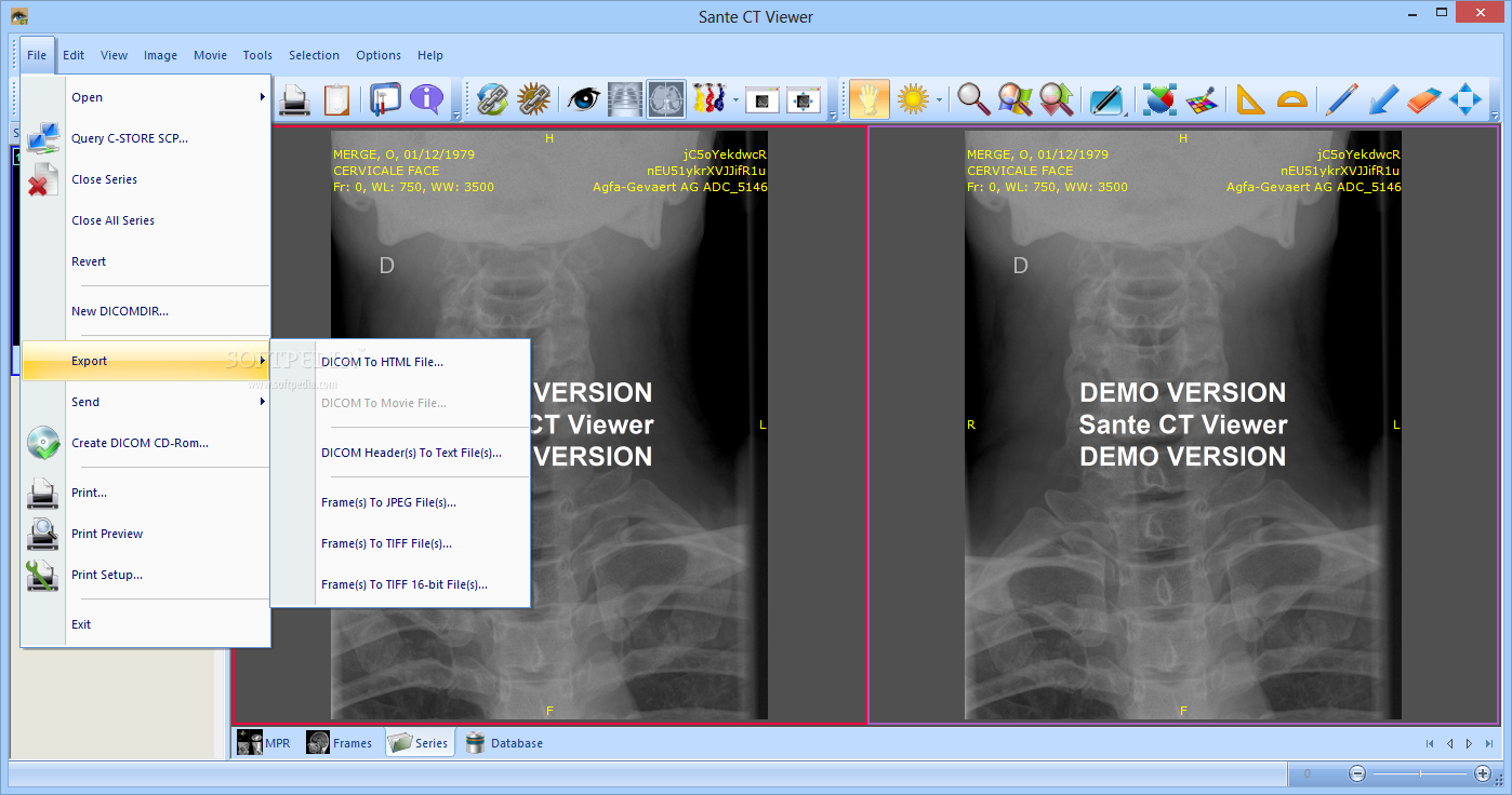 download the new version for ipod Sante DICOM Viewer Pro 12.2.5