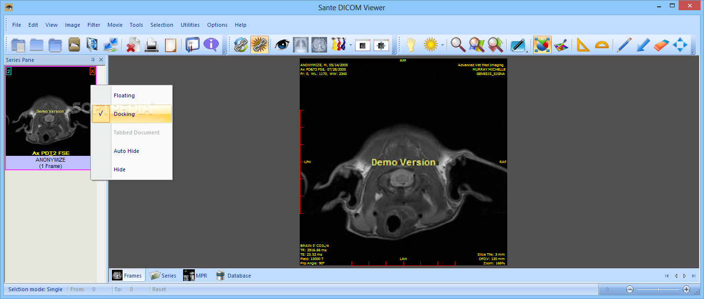 for android download Sante DICOM Editor 8.2.5