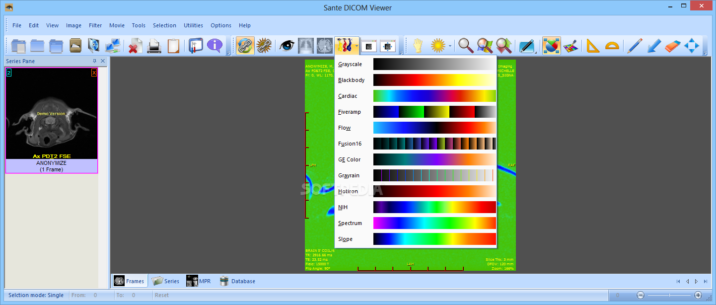 Sante DICOM Viewer Pro 12.2.5 for ios download