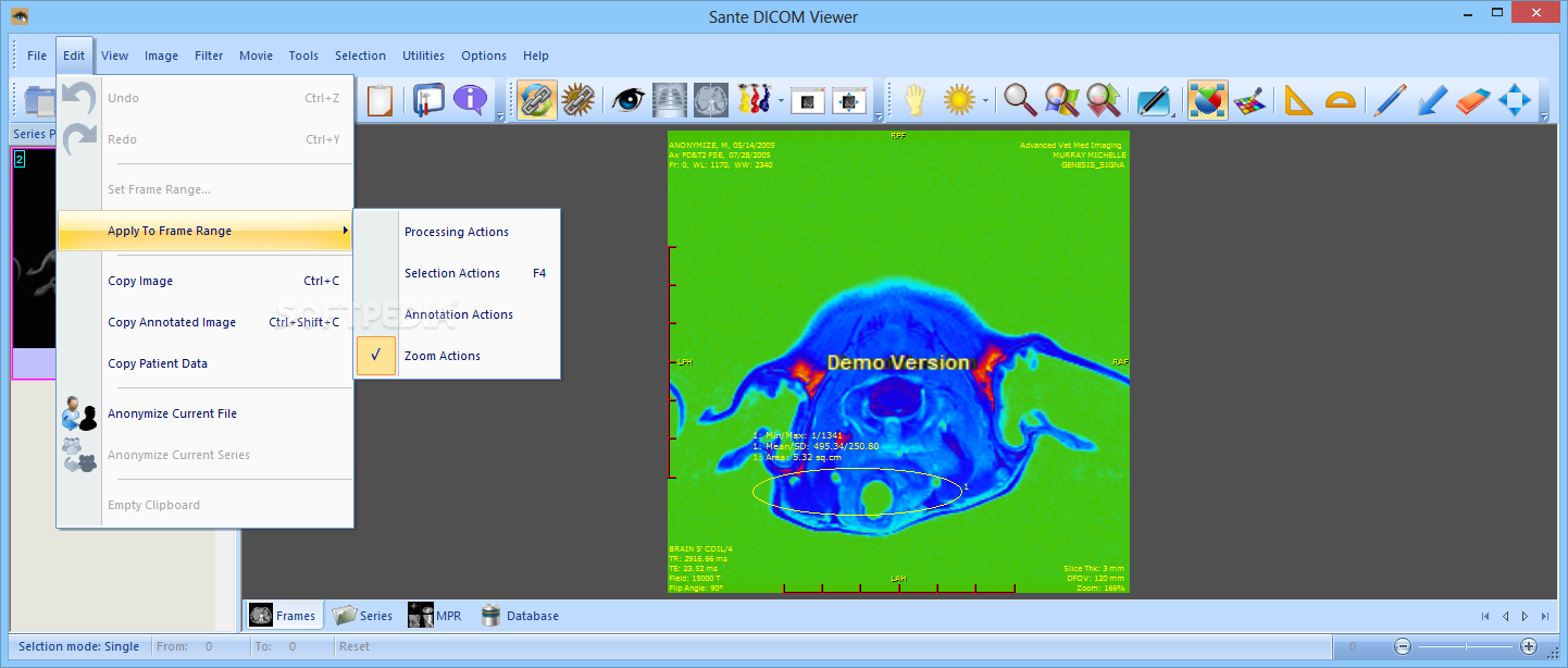 Sante DICOM Viewer Pro 12.2.5 for mac download free