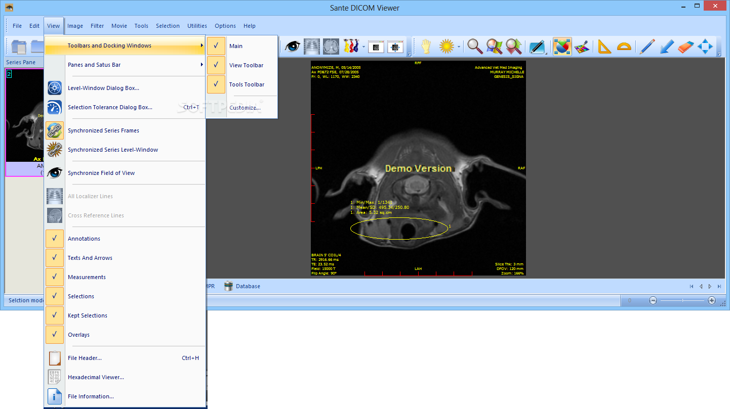Sante DICOM Viewer Pro 14.0.1 download the last version for ipod
